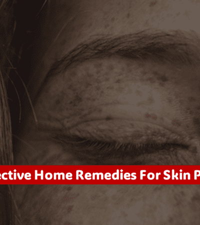 17 Effective Home Remedies For Skin Pores