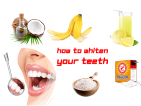 How To Whiten Your Teeth